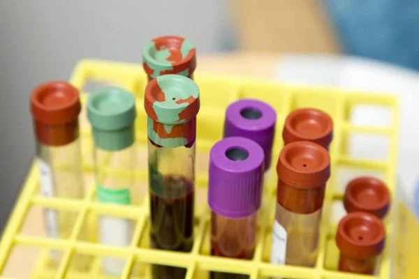 4ª onda: testei positivo para Covid, até quando preciso ficar isolado? 10