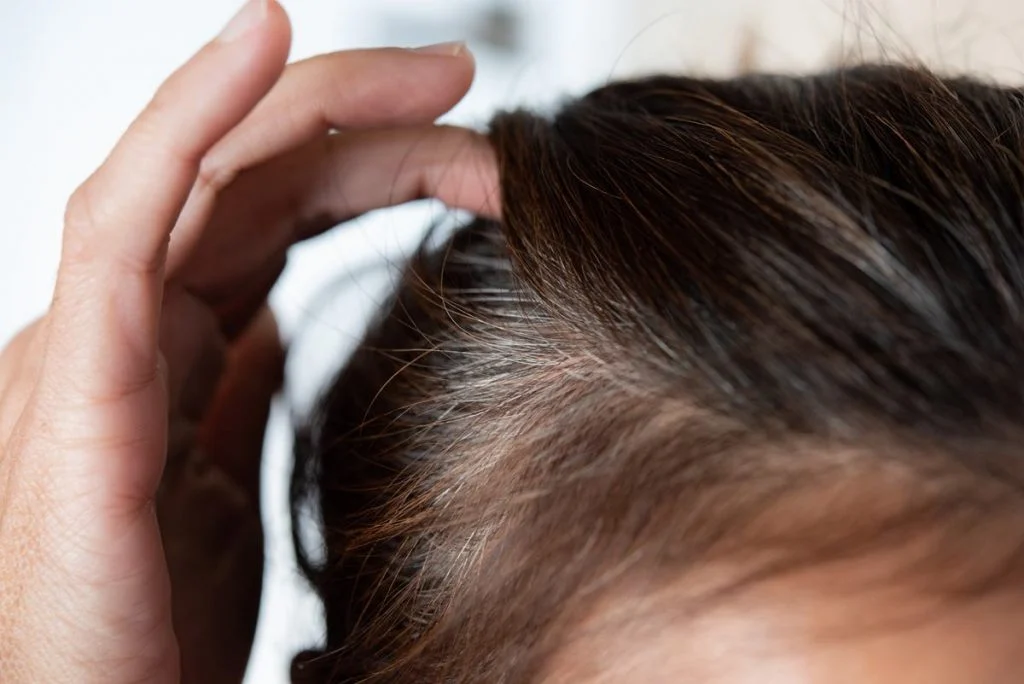 Dá para reverter? Médico revela 15 curiosidades sobre o cabelo branco 4