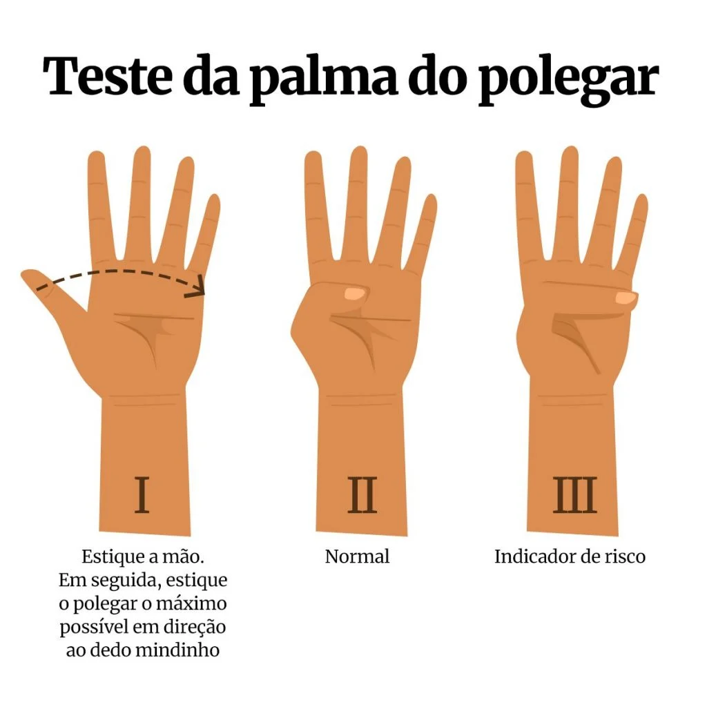 Confira teste com a mão que ajuda a identificar doença cardiovascular 2