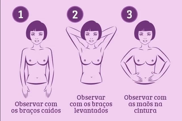 Câncer de mama: saiba qual o sinal de alerta menos conhecido da doença 9
