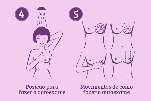 Câncer de mama: saiba qual o sinal de alerta menos conhecido da doença 10