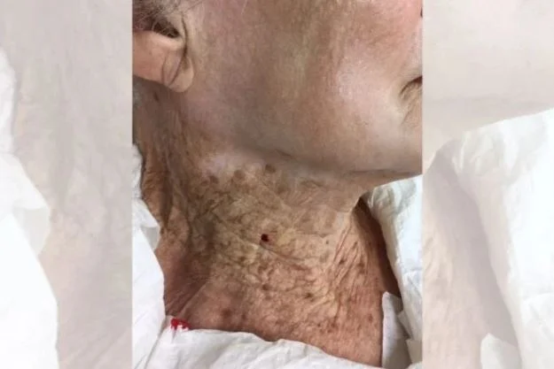Facial ou corporal: veja o tipo de protetor solar ideal para o pescoço 4