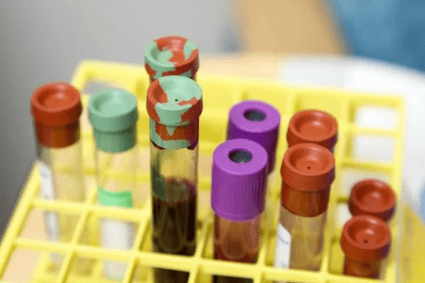 Tripledemia: entenda o que é e quais são os riscos para você 11